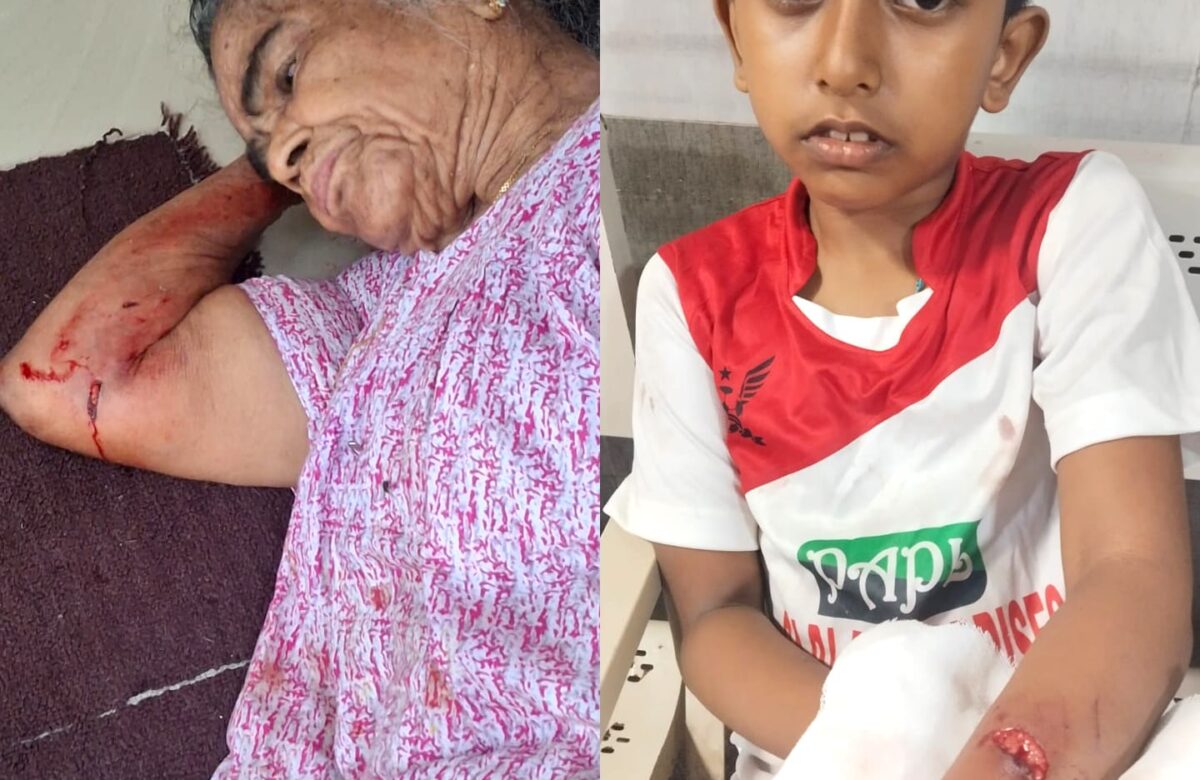 പാമ്പാക്കുടയിൽ തെരുവ് നായ ആക്രമണം;  കുട്ടി ഉൾപ്പടെ മൂന്ന് പേർക്ക് പരുക്ക്